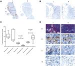 FOXP3 Antibody in Immunohistochemistry (IHC)