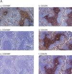 FOXP3 Antibody in Immunohistochemistry (IHC)