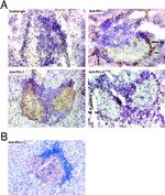 CD273 (B7-DC) Antibody in Immunohistochemistry (IHC)