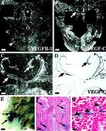 VEGF Receptor 3 Antibody in Immunohistochemistry (IHC)