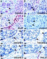 VEGF Receptor 3 Antibody in Immunohistochemistry (IHC)