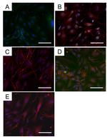 Myosin 4 Antibody in Immunocytochemistry (ICC/IF)