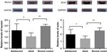 Myosin 4 Antibody in Western Blot (WB)