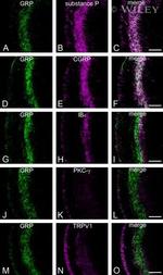 PKC gamma Antibody in Immunohistochemistry (IHC)