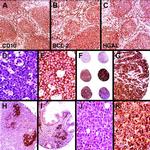 HGAL Antibody in Immunohistochemistry (IHC)