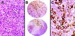 HGAL Antibody in Immunohistochemistry (IHC)