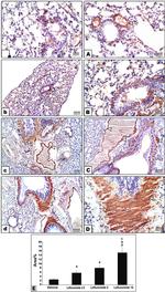 Alpha-Smooth Muscle Actin Antibody in Immunohistochemistry (IHC)