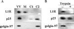 Golgin-97 Antibody in Western Blot (WB)