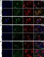 GFAP Antibody in Immunohistochemistry (IHC)