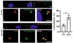 ATP Synthase beta Antibody in Immunocytochemistry (ICC/IF)