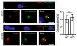 ATP Synthase beta Antibody in Immunocytochemistry (ICC/IF)