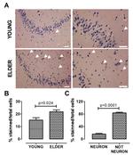 AHR Antibody in Immunohistochemistry, Immunohistochemistry (PFA fixed) (IHC, IHC (PFA))