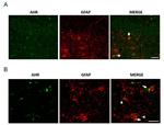 AHR Antibody in Immunocytochemistry, Immunohistochemistry (PFA fixed) (ICC/IF, IHC (PFA))