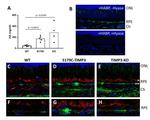 Ezrin Antibody in Immunohistochemistry (IHC)