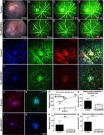 COX2 Antibody in Immunohistochemistry (IHC)