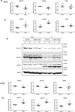 VGLUT1 Antibody in Western Blot (WB)