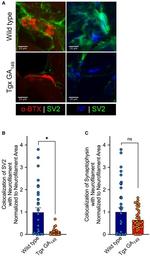 Synaptophysin Antibody in Immunocytochemistry (ICC/IF)