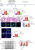 Alpha-Smooth Muscle Actin Antibody in Immunocytochemistry (ICC/IF)