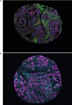 Cytokeratin Pan Type I/II Antibody in Immunocytochemistry (ICC/IF)