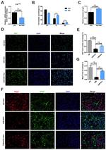 GFAP Antibody in Immunocytochemistry (ICC/IF)