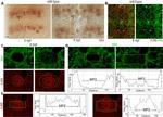 beta Galactosidase Antibody in Immunocytochemistry (ICC/IF)