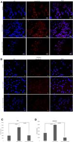 TLR3 Antibody in Immunocytochemistry (ICC/IF)