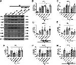 MC1R Antibody in Western Blot (WB)