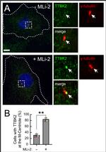 gamma Tubulin Antibody in Immunocytochemistry (ICC/IF)