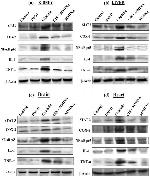 COX2 Antibody in Western Blot (WB)