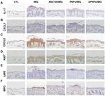 CXCL1 Antibody in Immunohistochemistry (IHC)