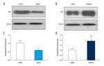 ATF2 Antibody in Western Blot (WB)