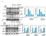 NQO1 Antibody in Western Blot (WB)