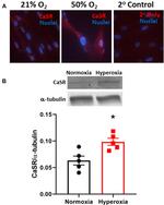 Calcium Sensing Receptor Antibody in Immunocytochemistry (ICC/IF)