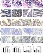 ZO-1 Antibody in Immunohistochemistry (IHC)