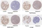 SDR16C5 Antibody in Immunohistochemistry (IHC)