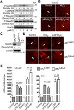 TGF beta-1,2,3 Antibody in Neutralization (Neu)