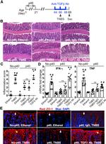 TGF beta-1,2,3 Antibody in Neutralization (Neu)