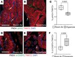 Cardiac Troponin T Antibody in Immunocytochemistry (ICC/IF)