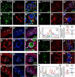 beta Galactosidase Antibody in Immunocytochemistry (ICC/IF)