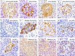 Phospho-Tau (Ser262) Antibody in Immunohistochemistry (IHC)