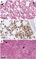 LAMP-2A Antibody in Immunohistochemistry (IHC)