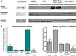 ACE2 Antibody in Western Blot (WB)