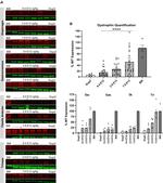 Sarcomeric alpha Actinin Antibody in Western Blot (WB)