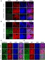 Vimentin Antibody in Immunohistochemistry (IHC)