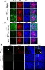 Vimentin Antibody in Immunohistochemistry (IHC)