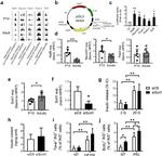 Insulin Antibody in ELISA (ELISA)