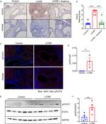 STAT3 Antibody in Immunohistochemistry (IHC)