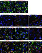 Connexin 26 Antibody in Immunohistochemistry (IHC)