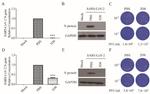 SARS Coronavirus Nucleocapsid Antibody in Western Blot (WB)