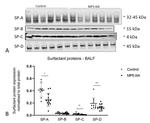 SFTPA1 Antibody in Western Blot (WB)